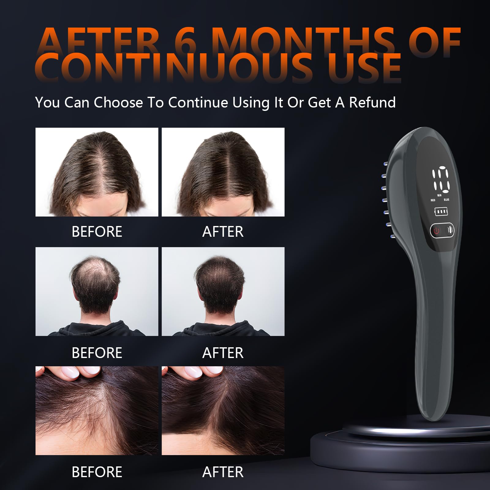 Jitesy Laser Therapy Hair Growth Comb packaged for home use.