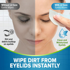 JJ CARE eyelid wipes moisturize while cleaning around the eyes for a refreshed feel.