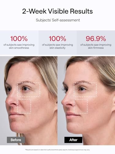 JMOON red light therapy face session delivering gentle rejuvenation and warmth.