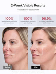 JMOON red light therapy face session delivering gentle rejuvenation and warmth.