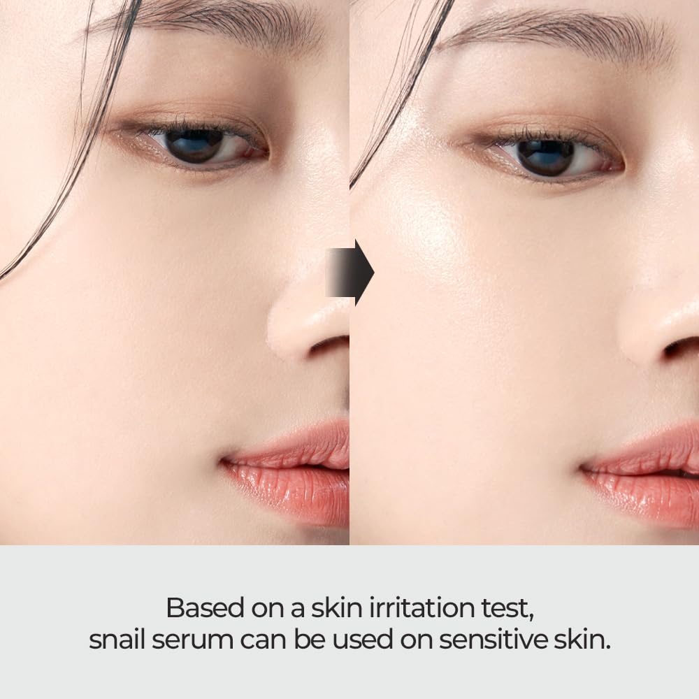 Hands applying JMsolution Skin Boost Snail 97% Serum on cheek for quick absorption.