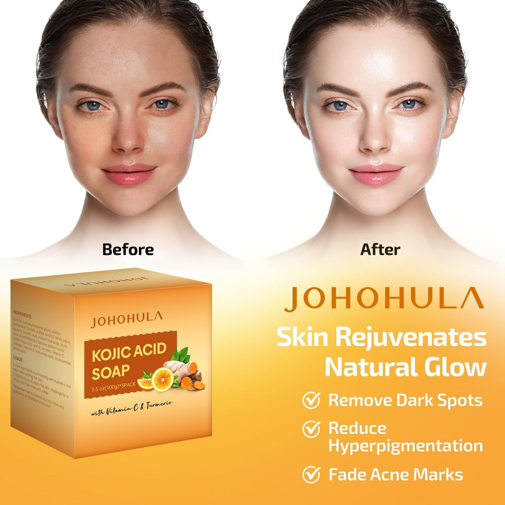Image 3 of Johohula soap bar emphasizes turmeric infusion for skin hydration.