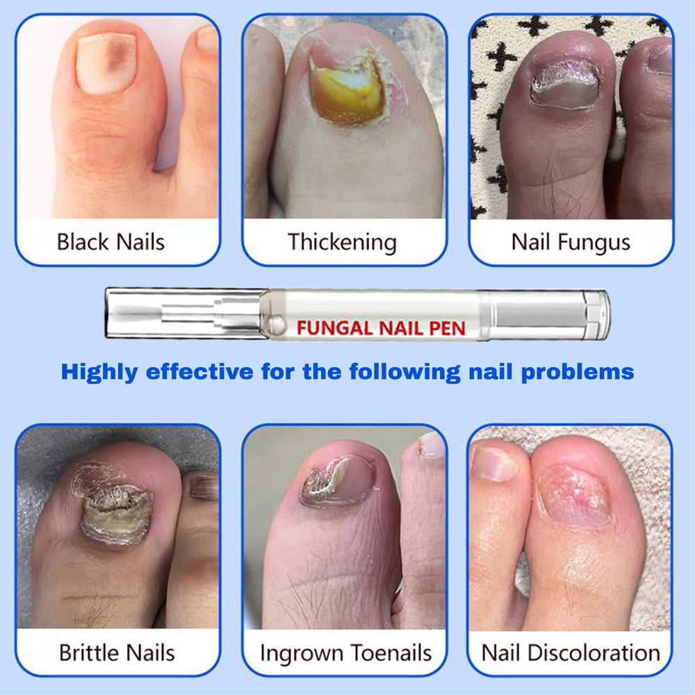 JONKEYPENY deep-penetrating formula works beneath the nail surface