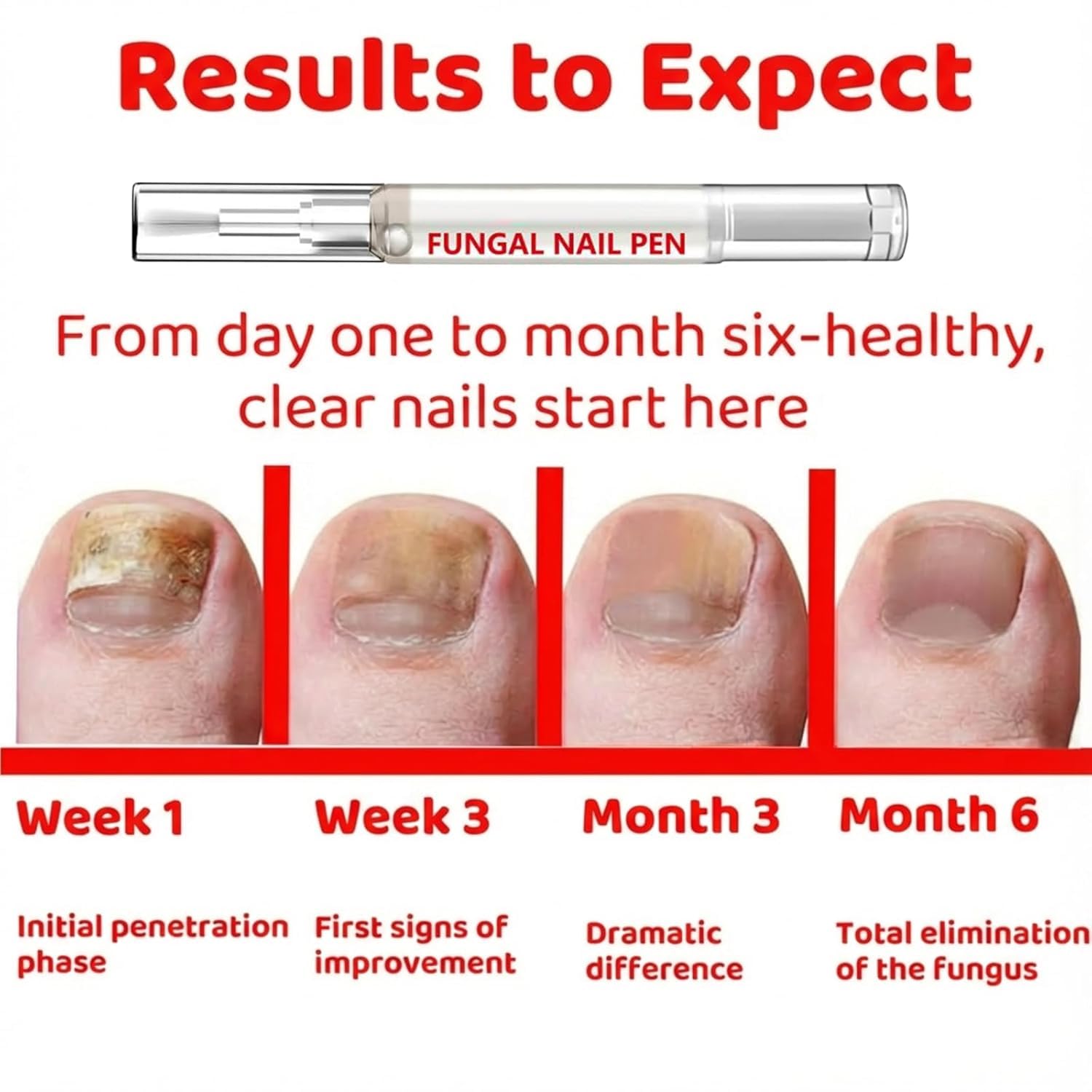 JONKEYPENY precise application to affected nail area