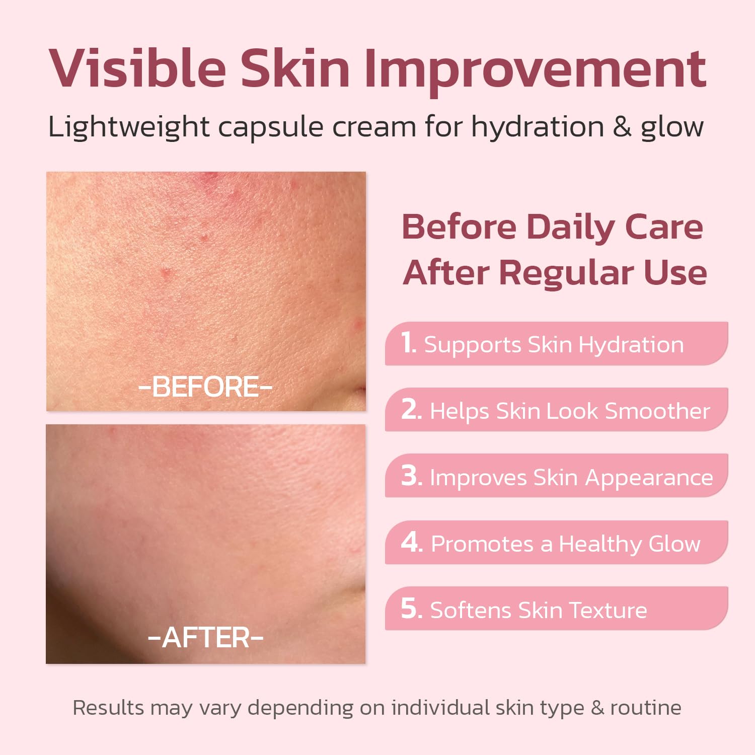 Jorceray 5 percent Niacinamide formula evens skin tone and reduces spots