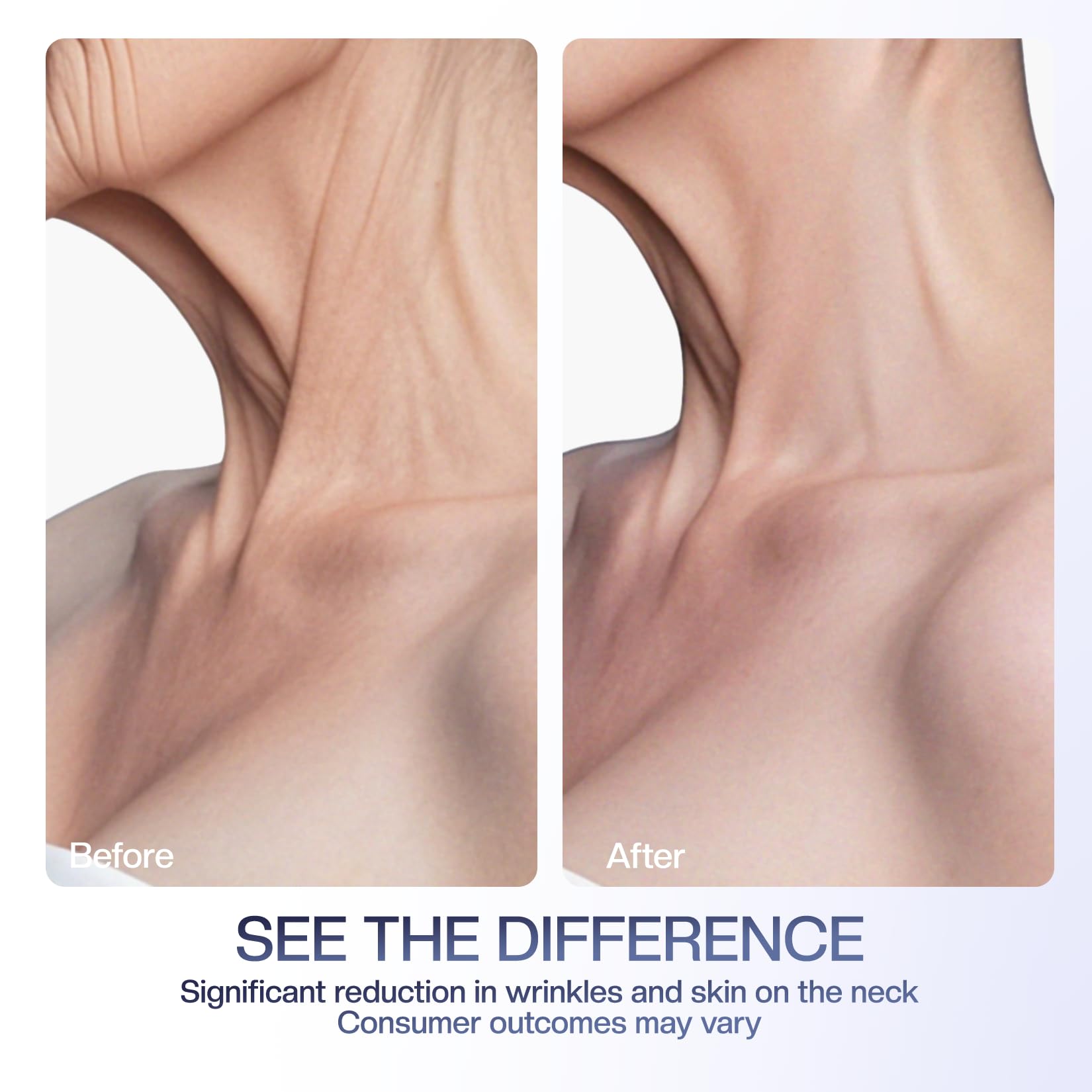Jtopyrt neck cream application scene suggesting lifting potential.