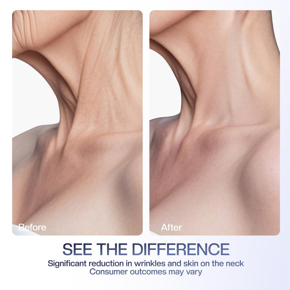 Jtopyrt neck cream application scene suggesting lifting potential.