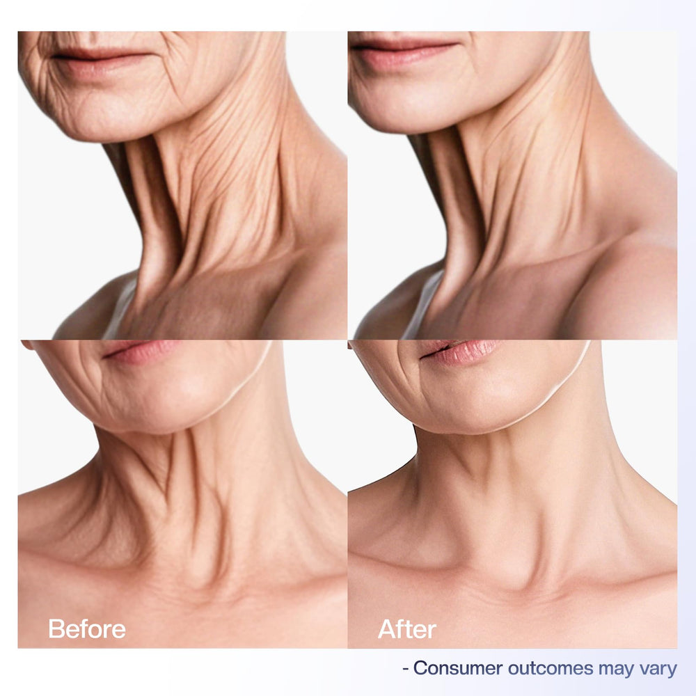 Jtopyrt neck cream hydration boost for visibly plumper skin.