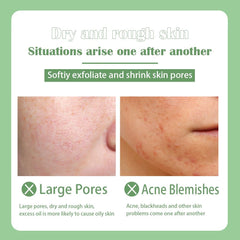 JUAAZIN peel-off mask drying time shows clean, ready-to-peel pores