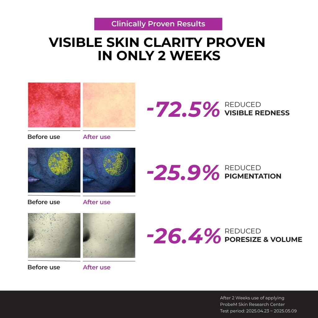 Hyaluronic acid hydration in JUMISO serum for glass skin feel.
