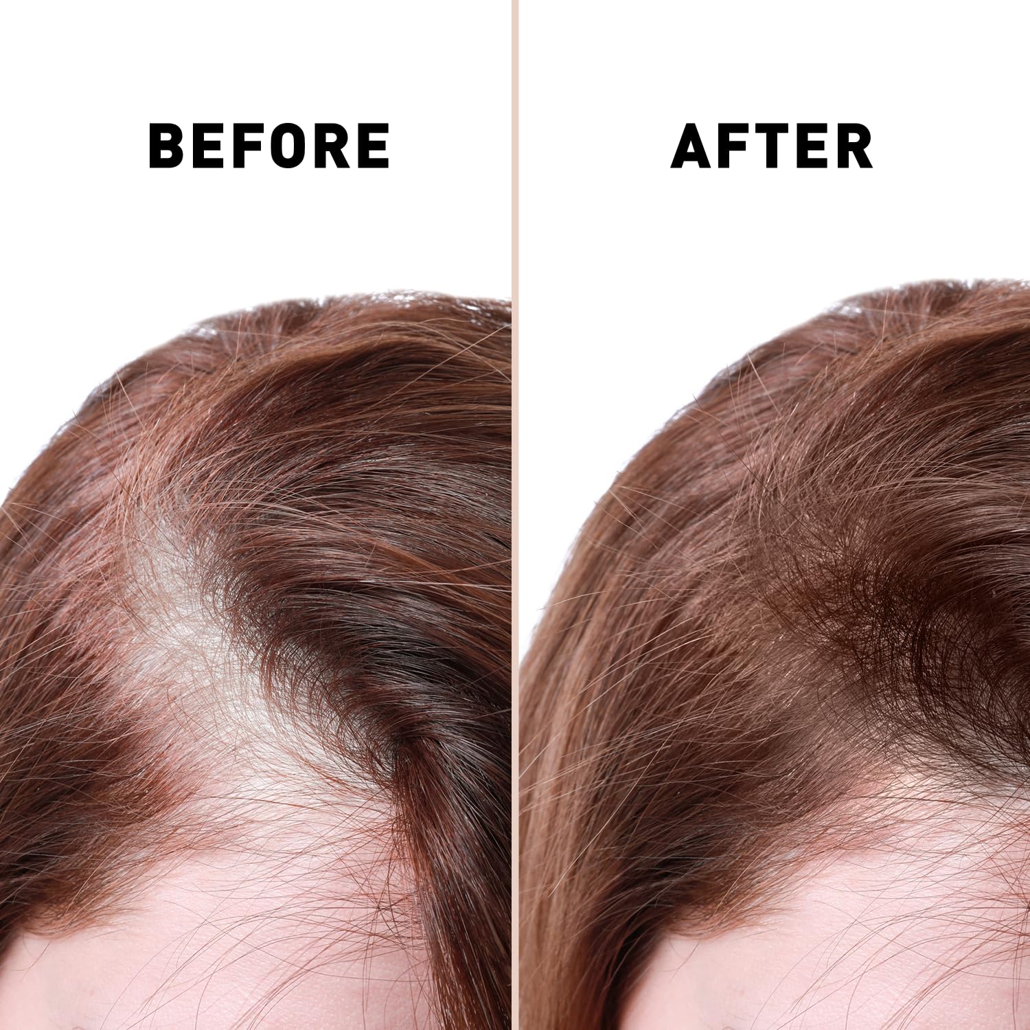 Natural ingredient blend nourishes scalp and hair health.