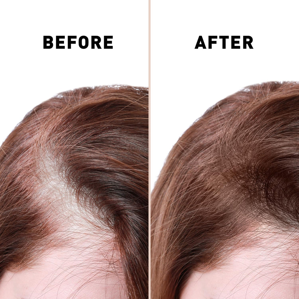 Natural ingredient blend nourishes scalp and hair health.