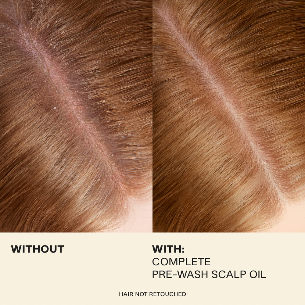 JVN Pre-Wash Scalp Oil applied to the scalp in a gentle massage to soothe.