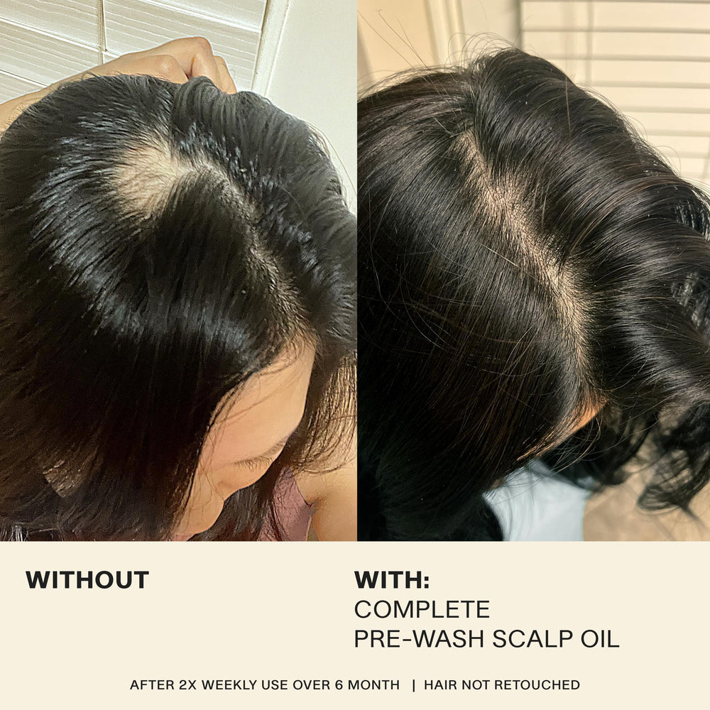JVN emphasizes rosemary and turmeric ingredients that support scalp comfort.