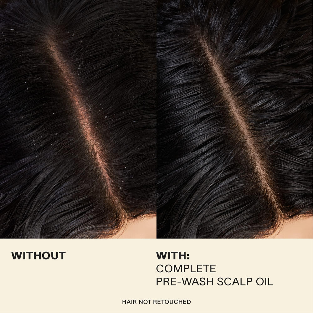 JVN bottle close-up communicates a premium, silicone-free approach to daily scalp health.