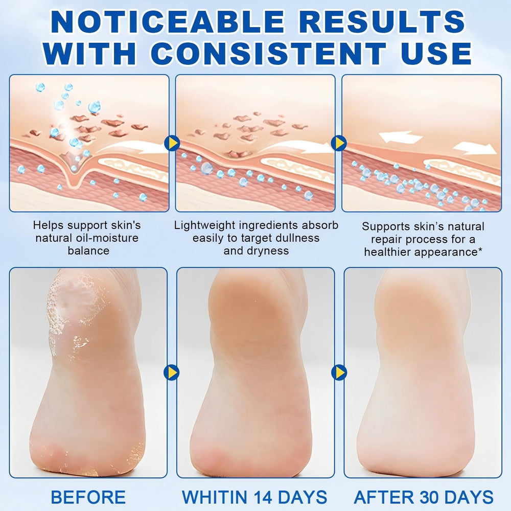 JWBVCTCR Urea Foot Cream Stick applied to heels for smoother skin