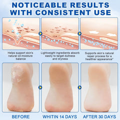 JWBVCTCR Urea Foot Cream Stick applied to heels for smoother skin