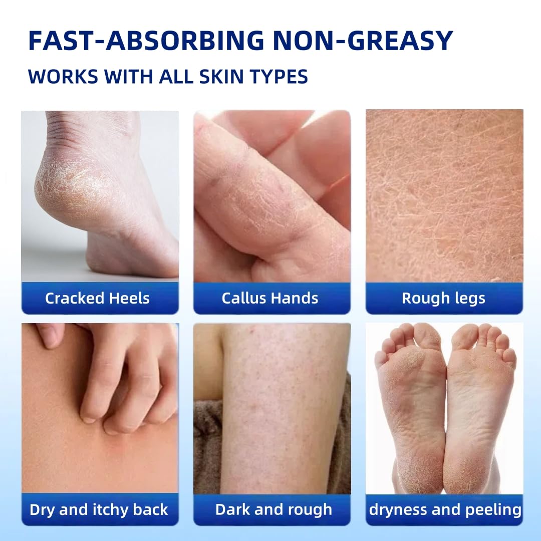 JYOVQXF aloe and hyaluronic moisture boost for dry feet.