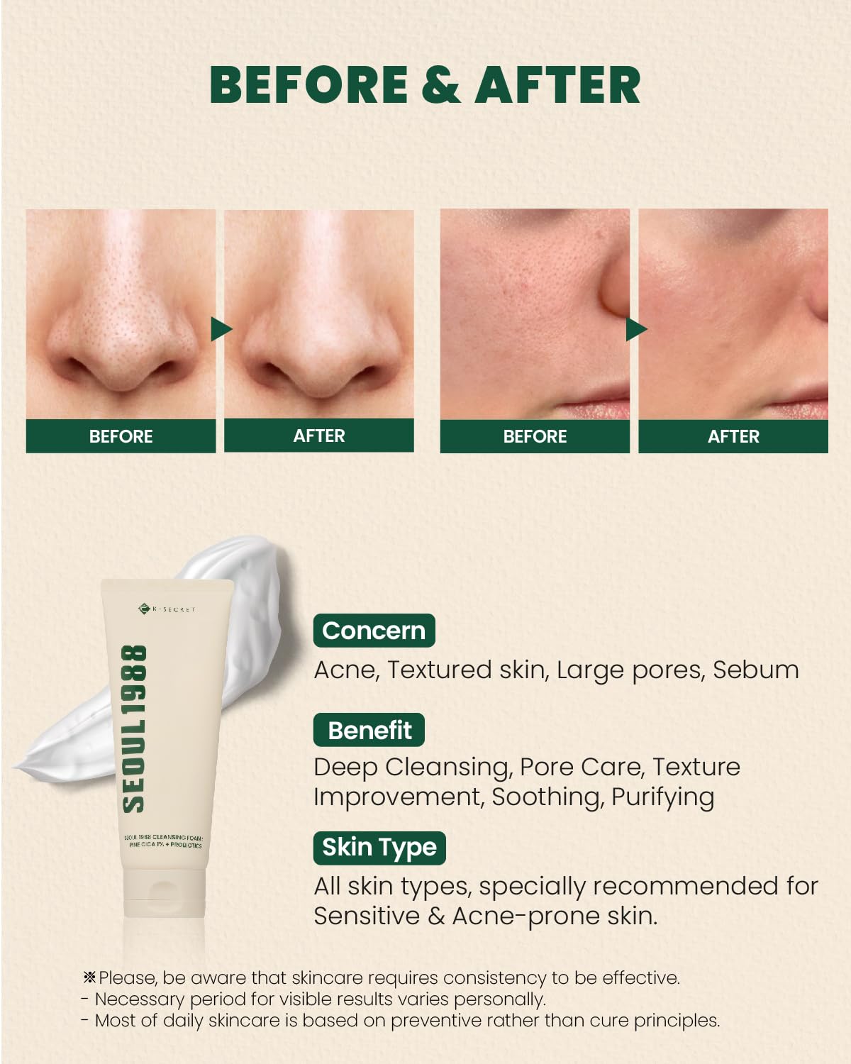 Illustration of Pine Cica Complex highlighting Pine Leaf and Centella Asiatica extracts for soothing care.