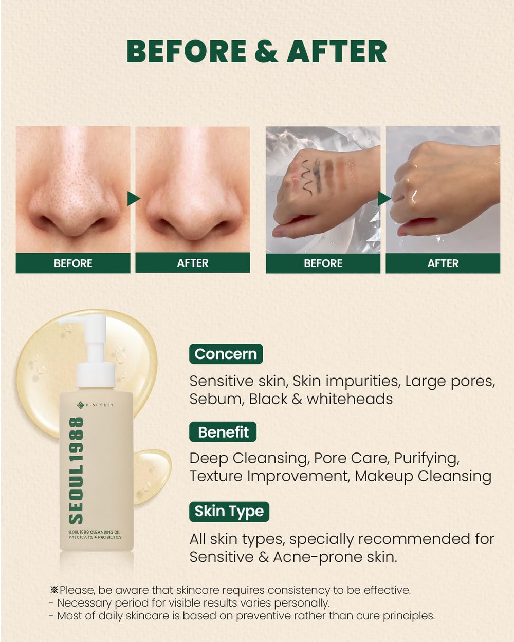 K-SECRET SEOUL 1988 Cica Cleansing Oil texture close-up showing oil-to-milk emulsification.