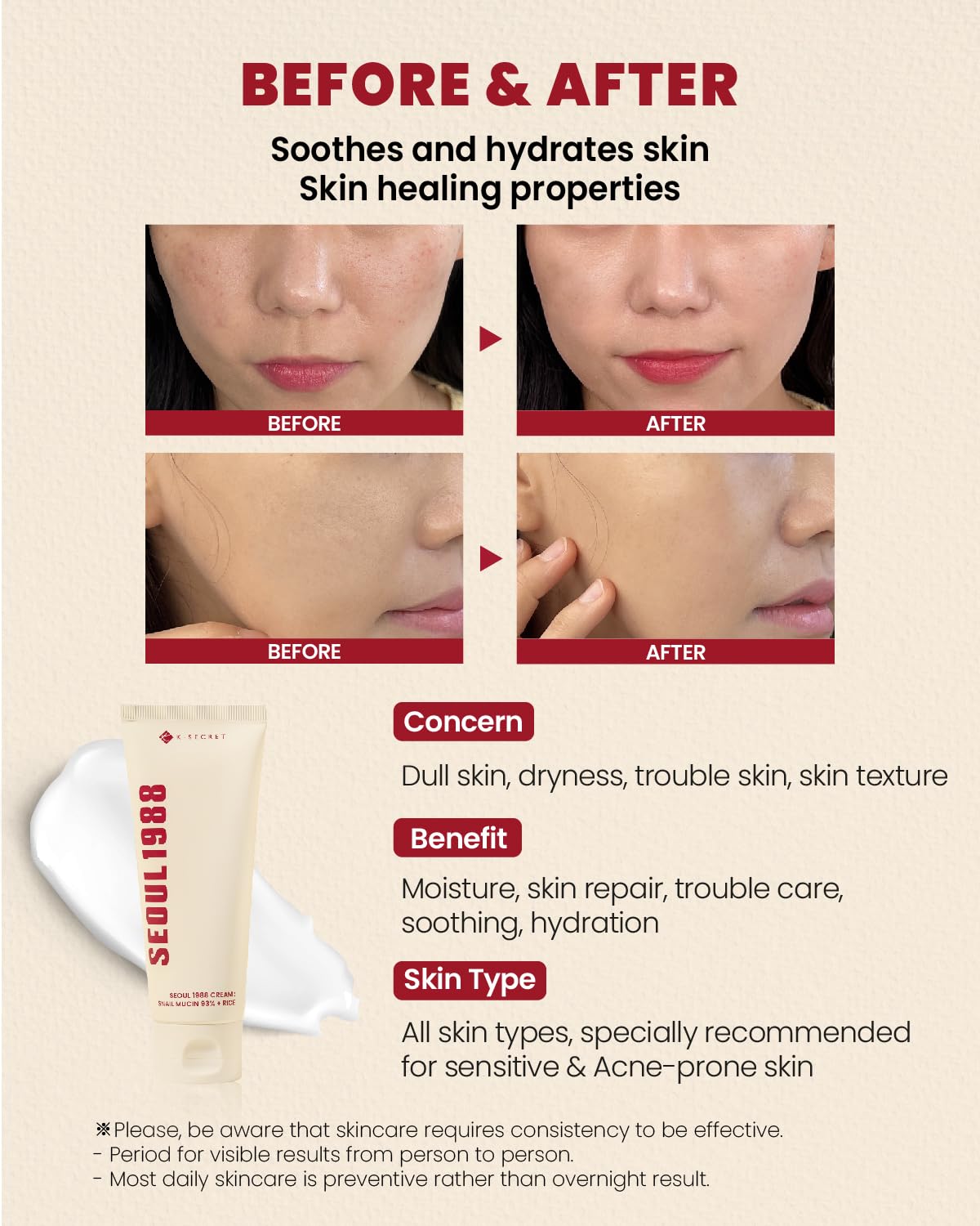 K-SECRET Seoul 1988 Snail Mucin 93% cream application demonstrates calm, non-greasy feel