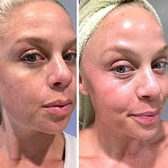 K6 Retinol Gel 0.1 on skin showing evening out tone and gentle exfoliation
