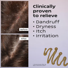 KAMEDIS Scalp Moisturizer Overnight Massage shows gentle nightly care for calm scalp.