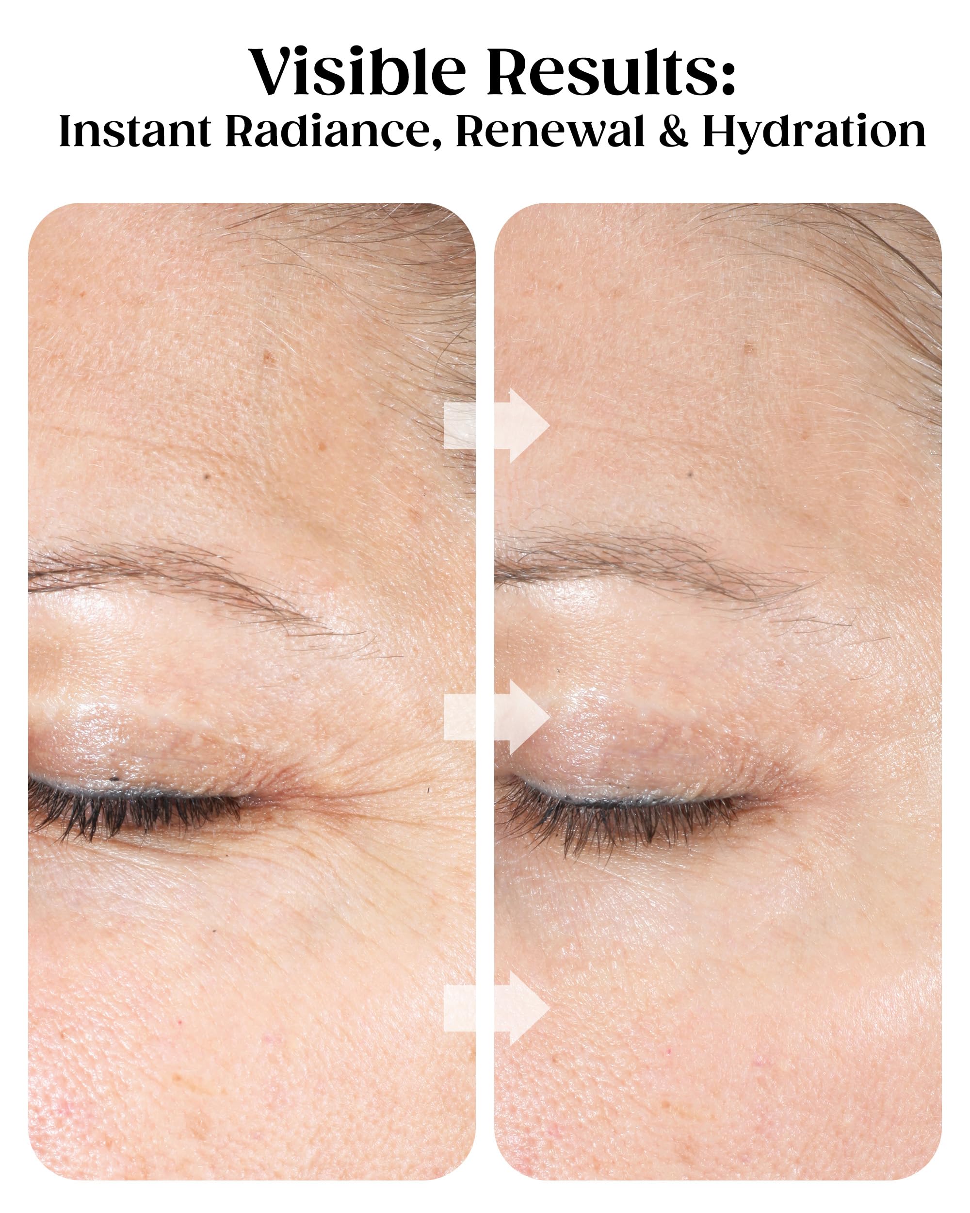 KAPLAN MD crushed diamonds texture provides gentle exfoliation for smoother skin.