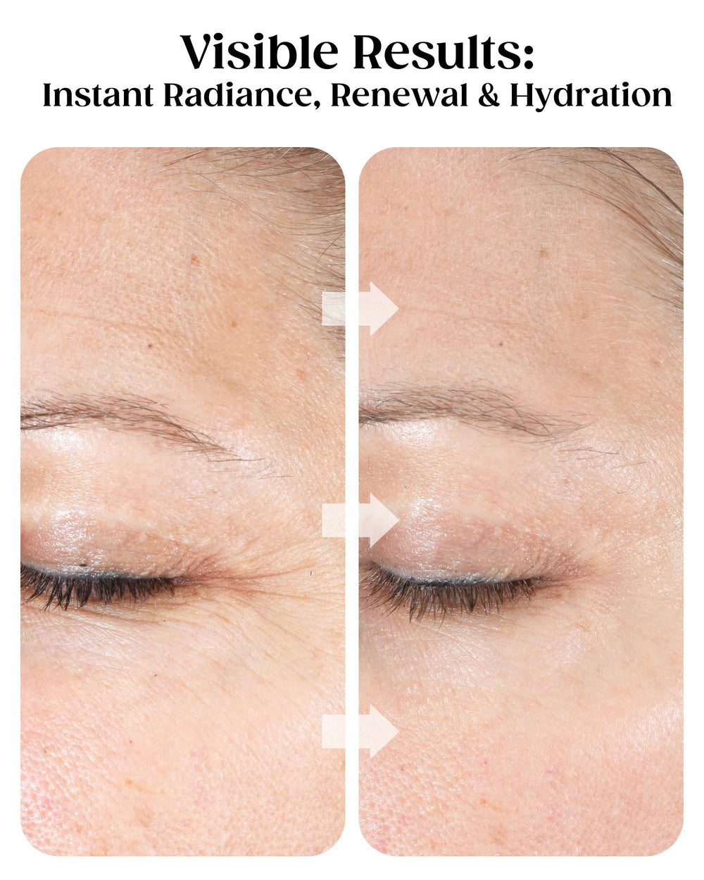 KAPLAN MD crushed diamonds texture provides gentle exfoliation for smoother skin.