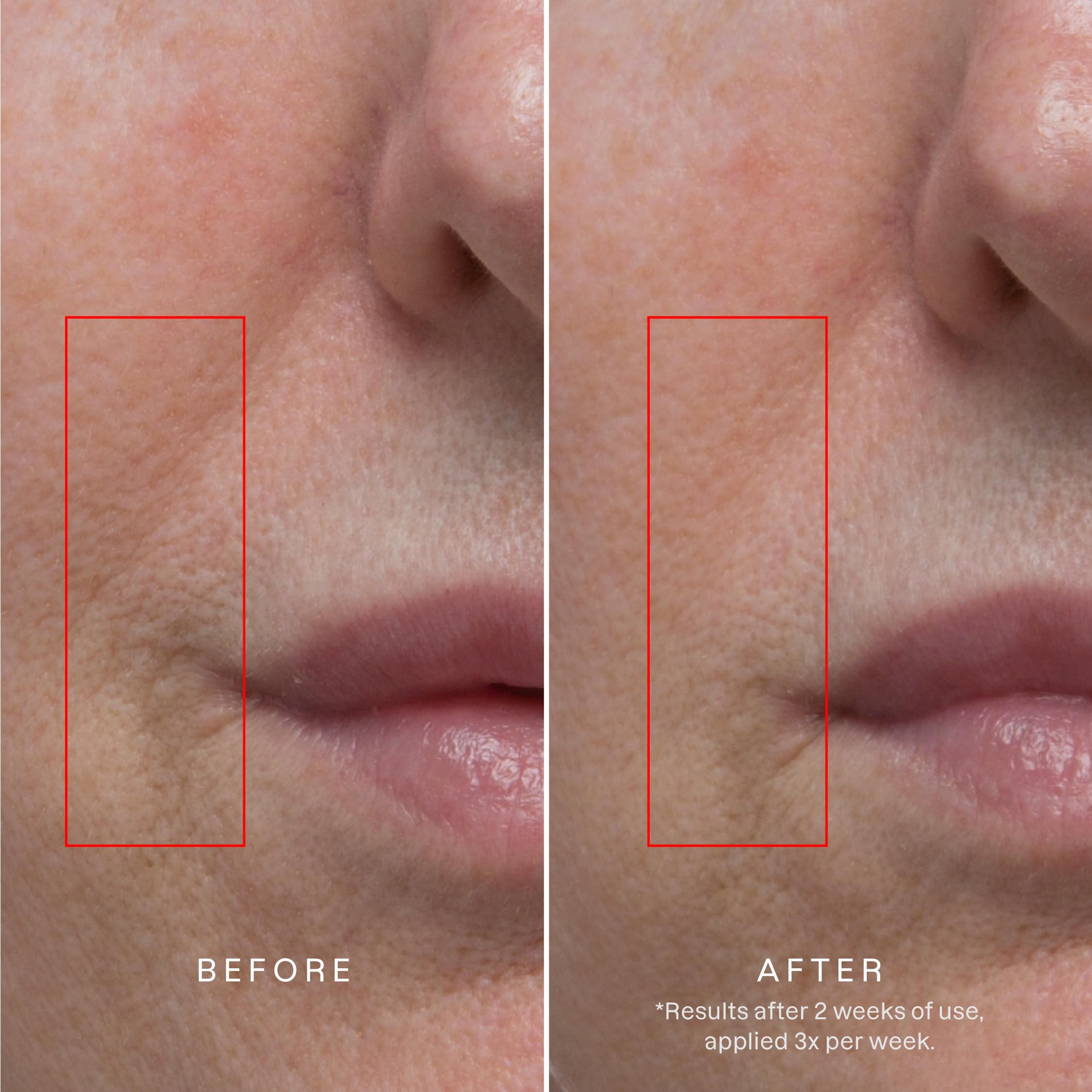 Karuna Age Rewind XL patch on facial area for overnight care
