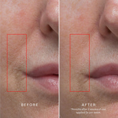 Karuna Age Rewind XL patch on facial area for overnight care
