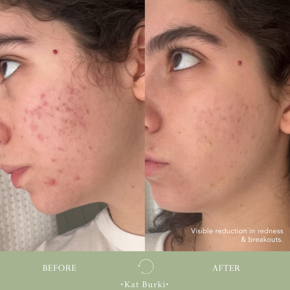 KAT BURKI VitaBiome Vitamin C helps balance tone and brighten