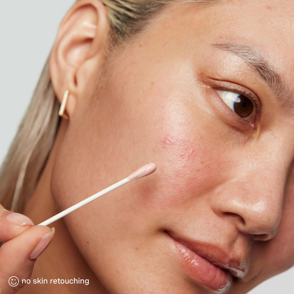Fragrance-free EradiKate formula ideal for sensitive skincare routines