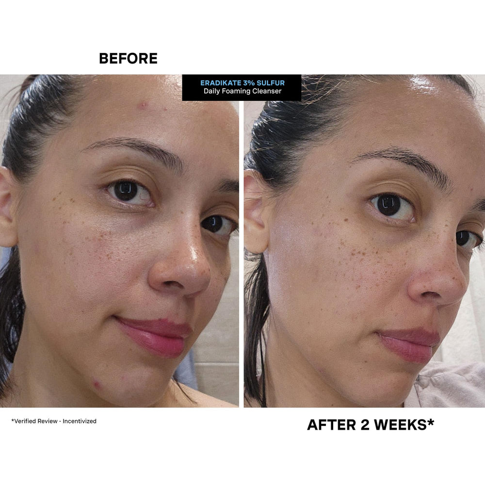 Hollywood clinic origin badge on packaging signaling professional skincare heritage.