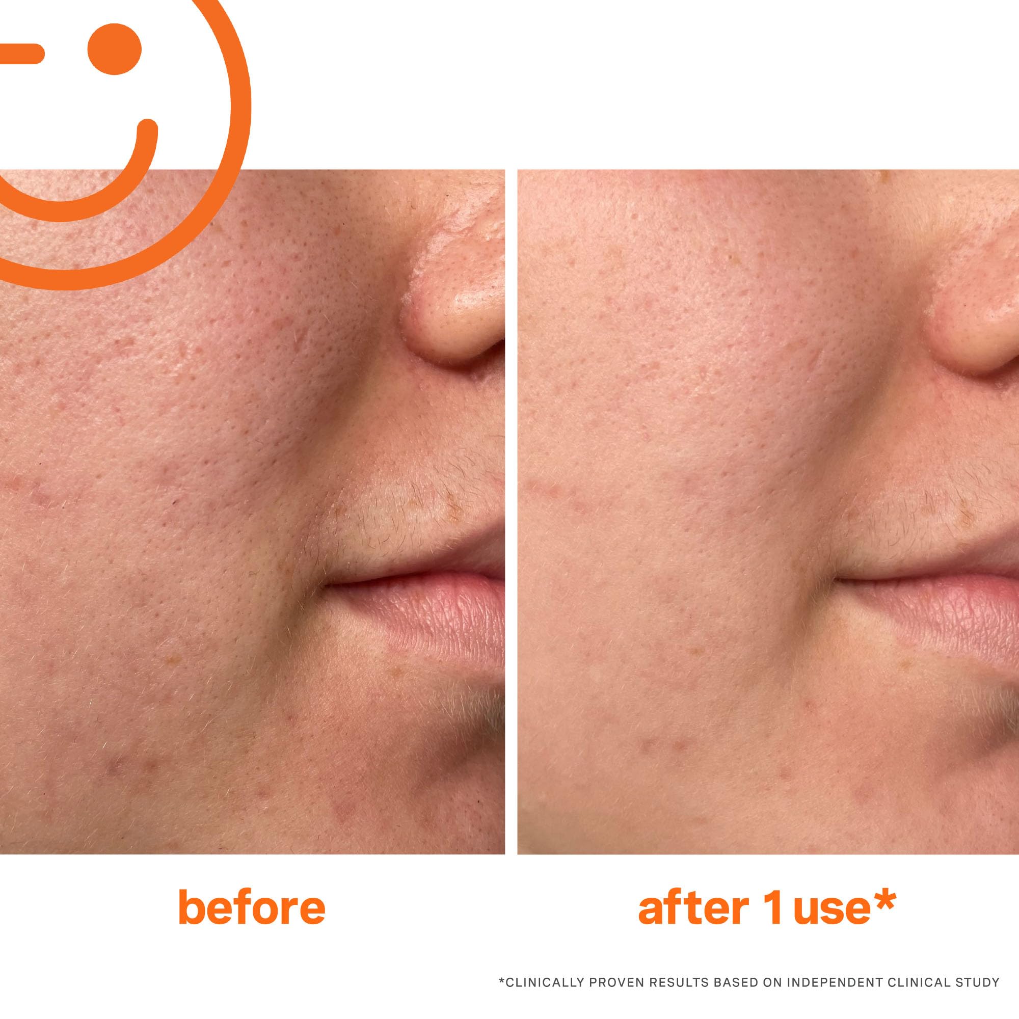 Kate Somerville Exfolikate Intensive features lactic acid and fruit enzymes