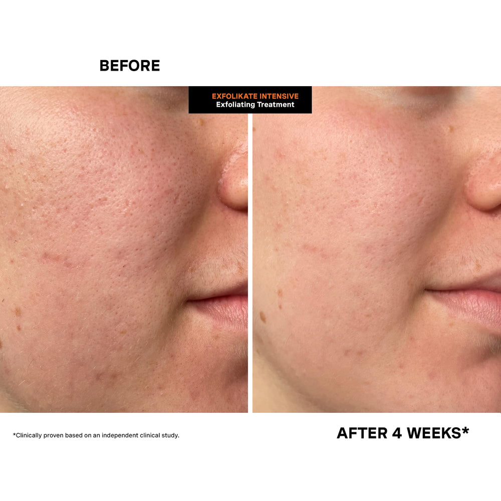 Kate Somerville Exfolikate bottle and label emphasize no parabens or sulfates
