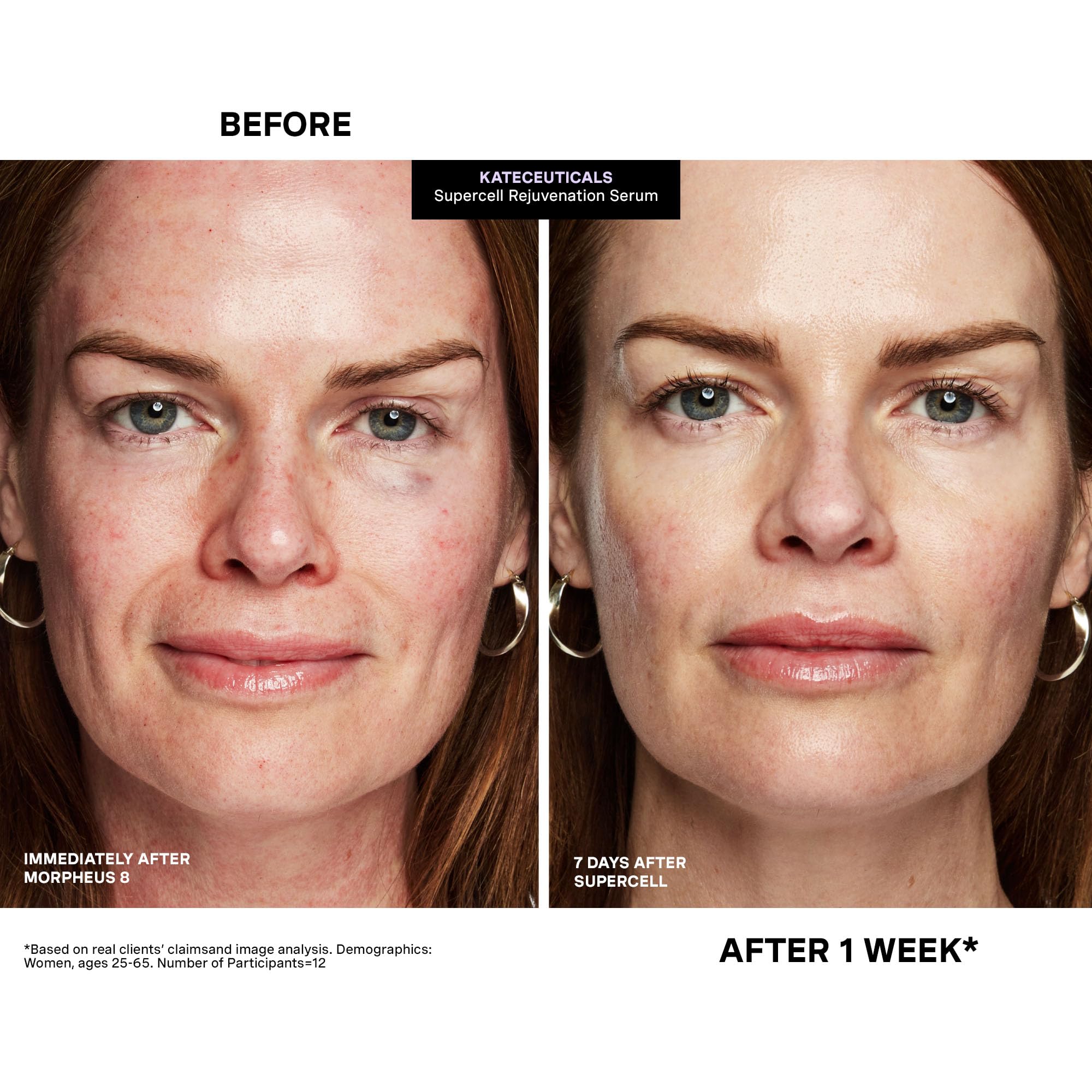 Packaging details emphasize vegan credentials of Kate Somerville SuperCell Serum.