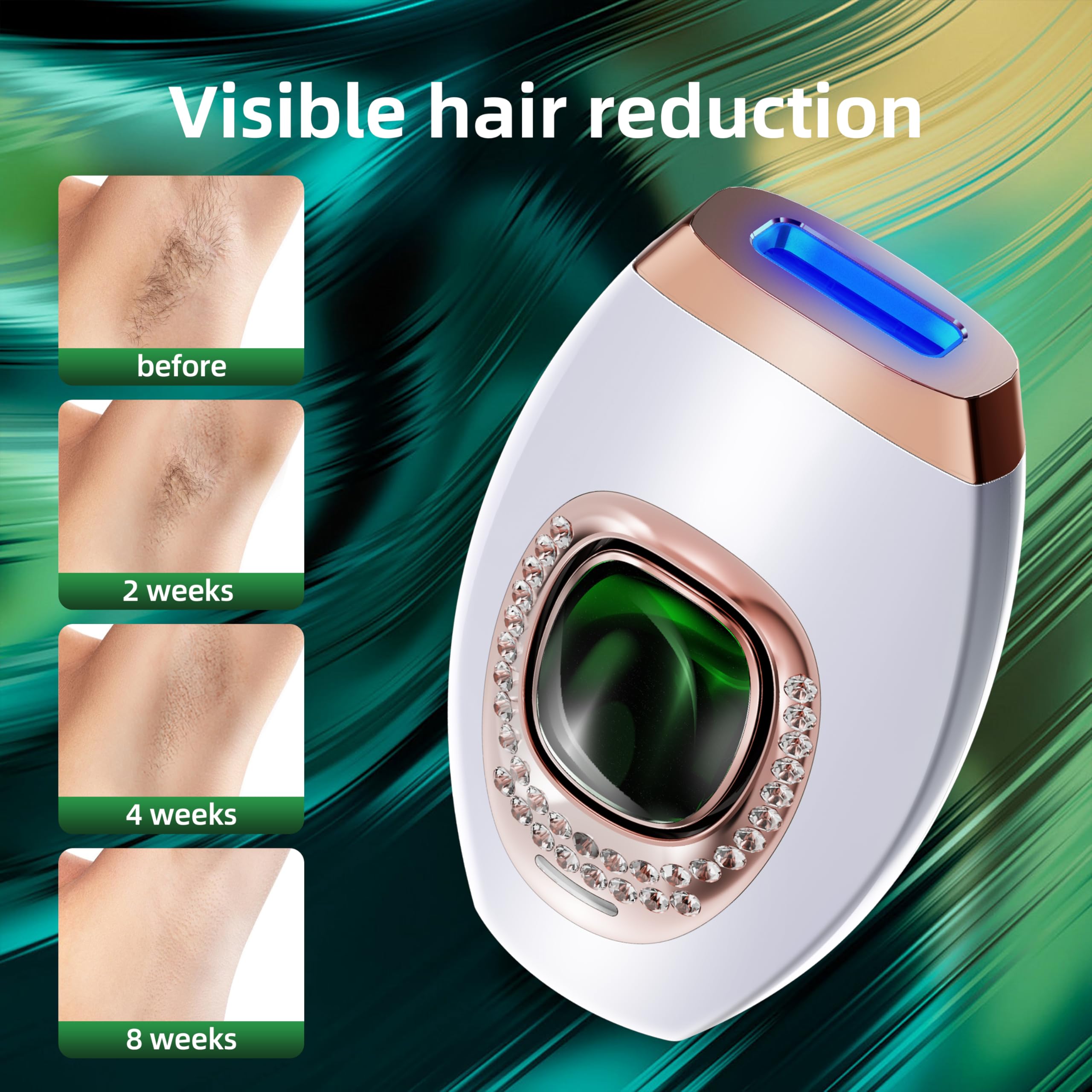 KDZ IPL device for at-home use offers convenient sessions
