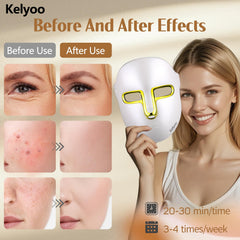 Kelyoo LED mask therapy session close-up highlighting multiple mode options