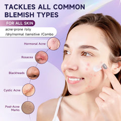 Kempc acne moisturizer texture for lightweight daily skincare routine.