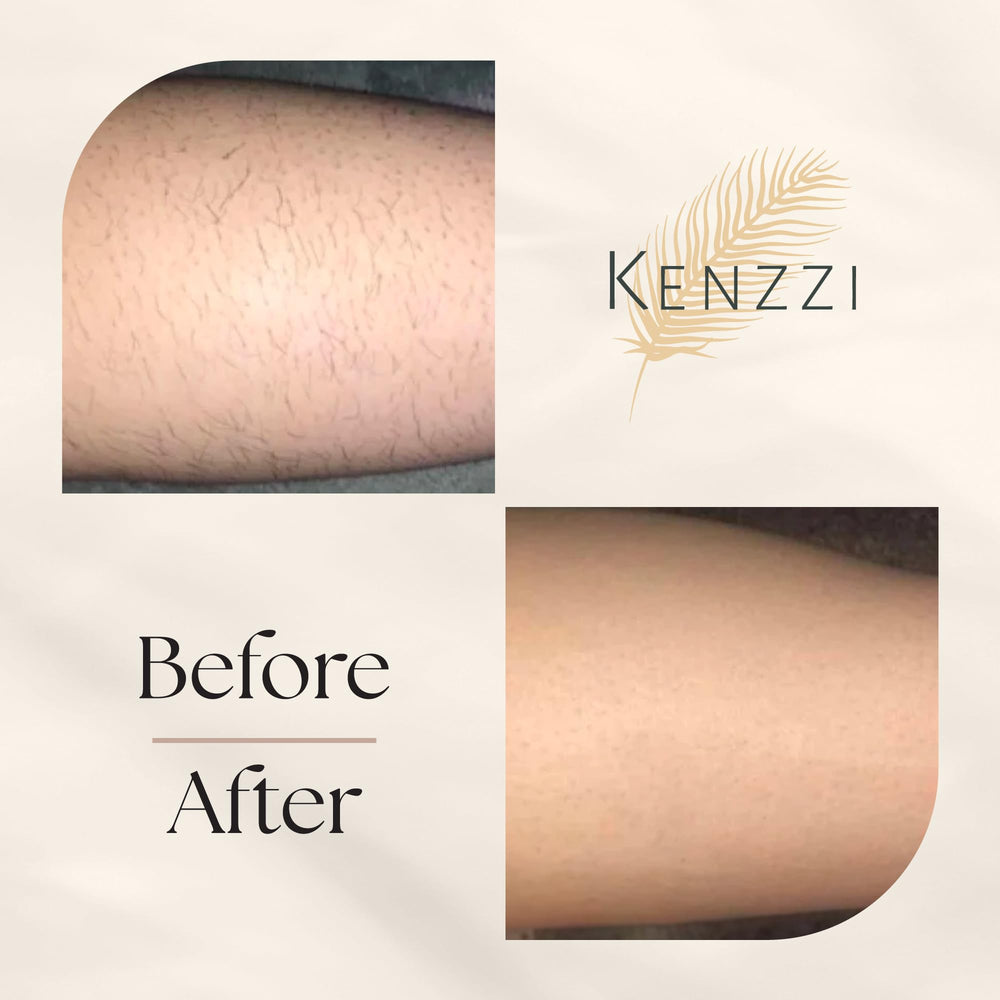 KENZZI IPL Handset durable design supports years of treatments