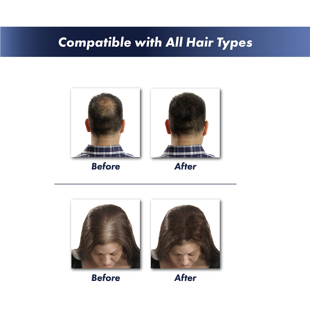 KeraFiber application action illustrating fibres bonding with existing hair for seamless coverage
