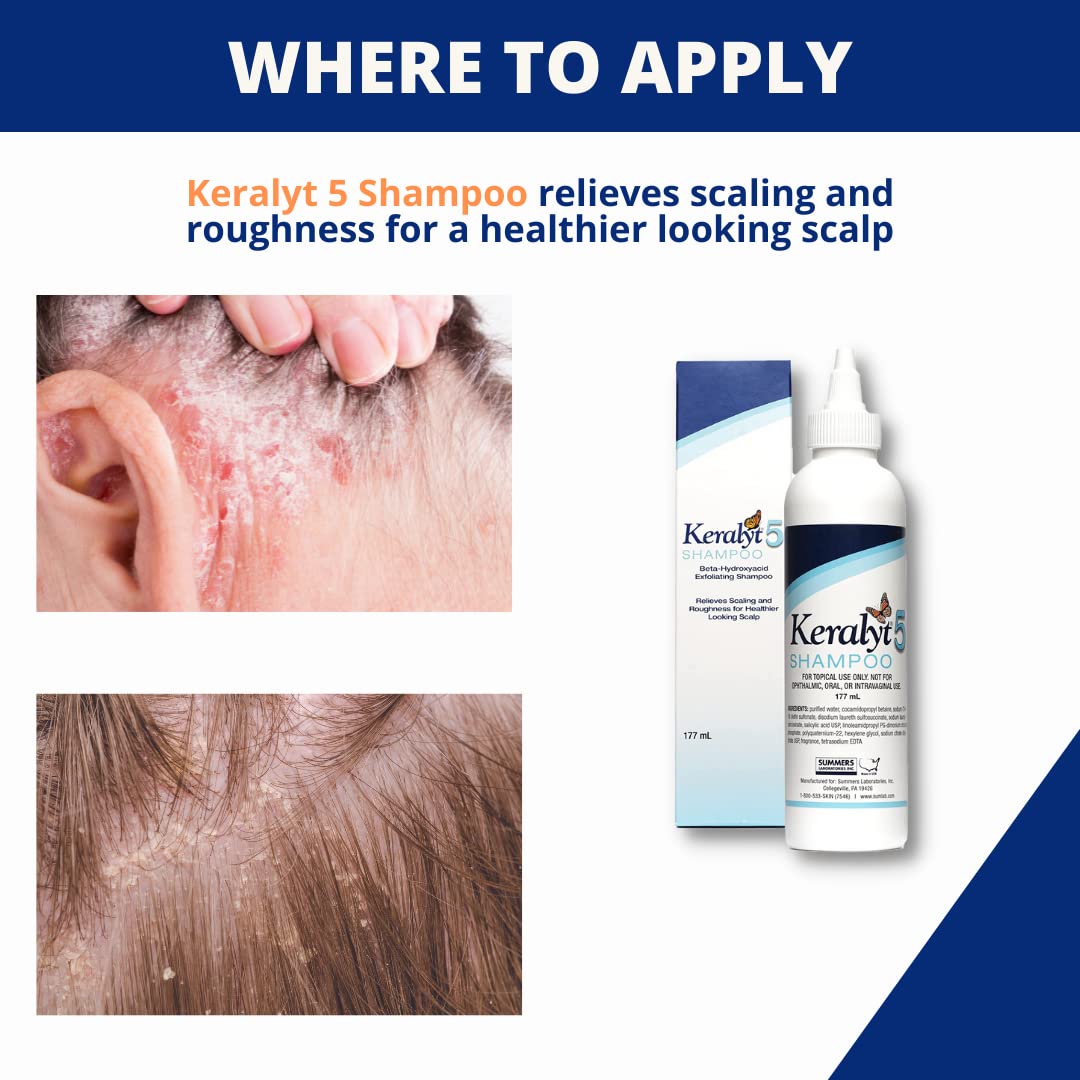 Keralyt 5 shampoo shower scene shows easy pre-shower application