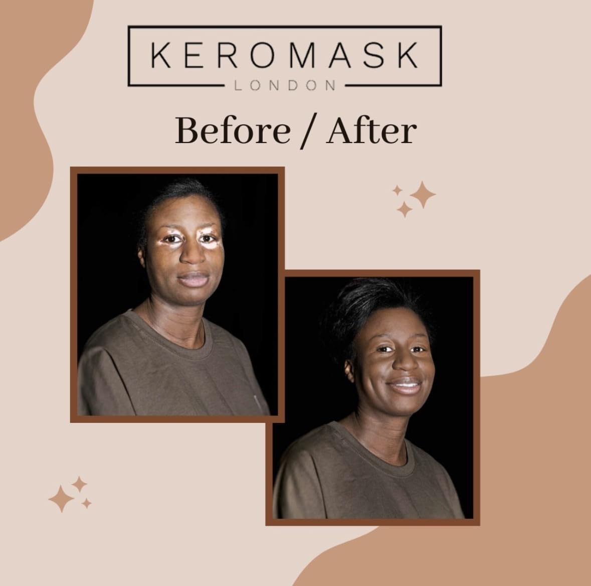 Keromask Full Coverage Concealer Light No.11 tattoo cover close-up demonstrates discreet camouflage