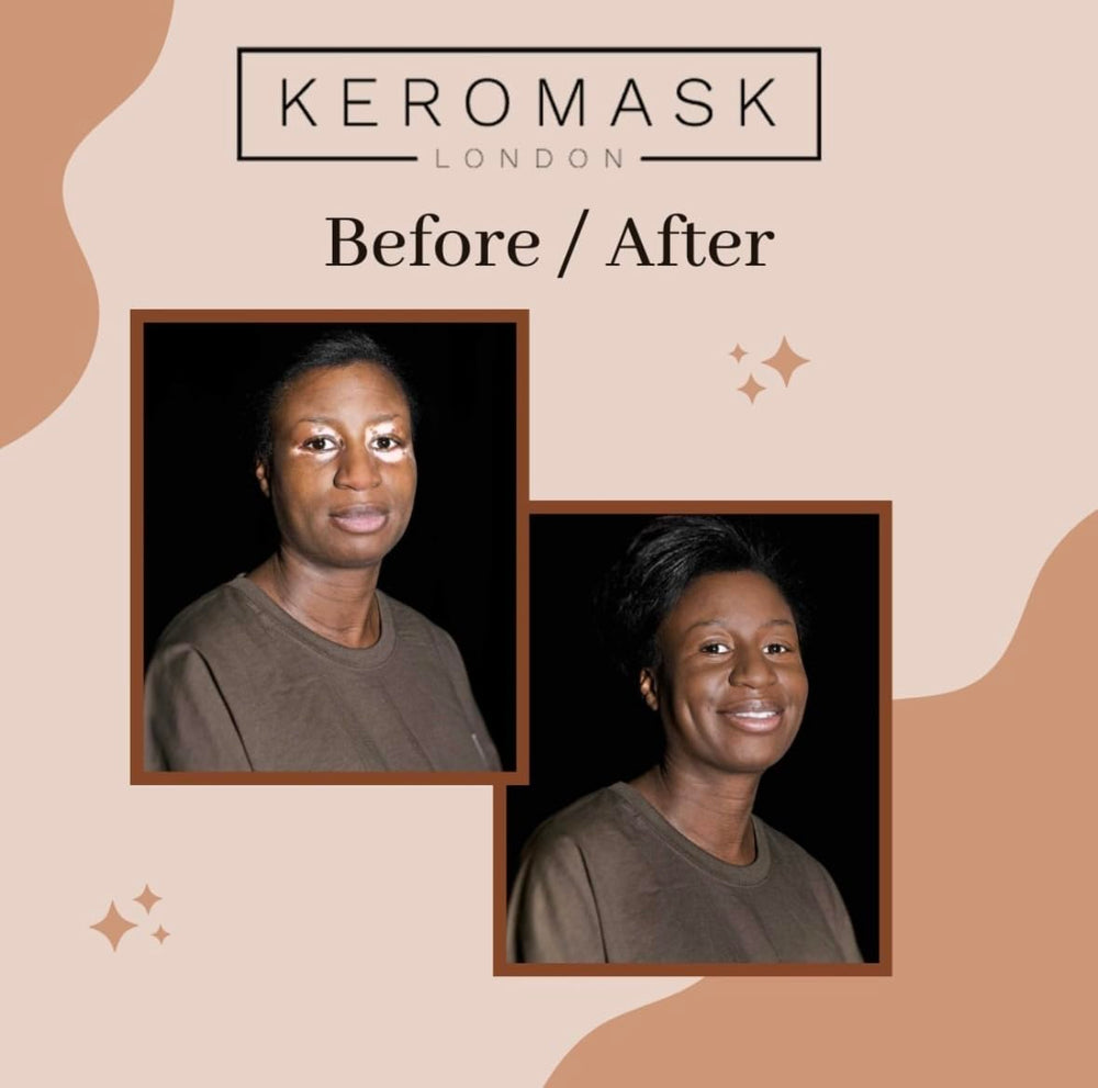 Keromask Full Coverage Concealer Light No.11 tattoo cover close-up demonstrates discreet camouflage