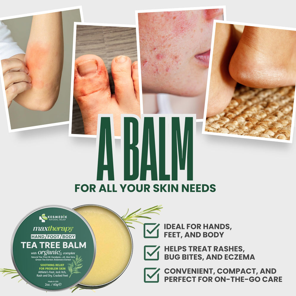 KESMEDIK Tea Tree Oil MaxTherapy Balm application on forearm provides itch relief.