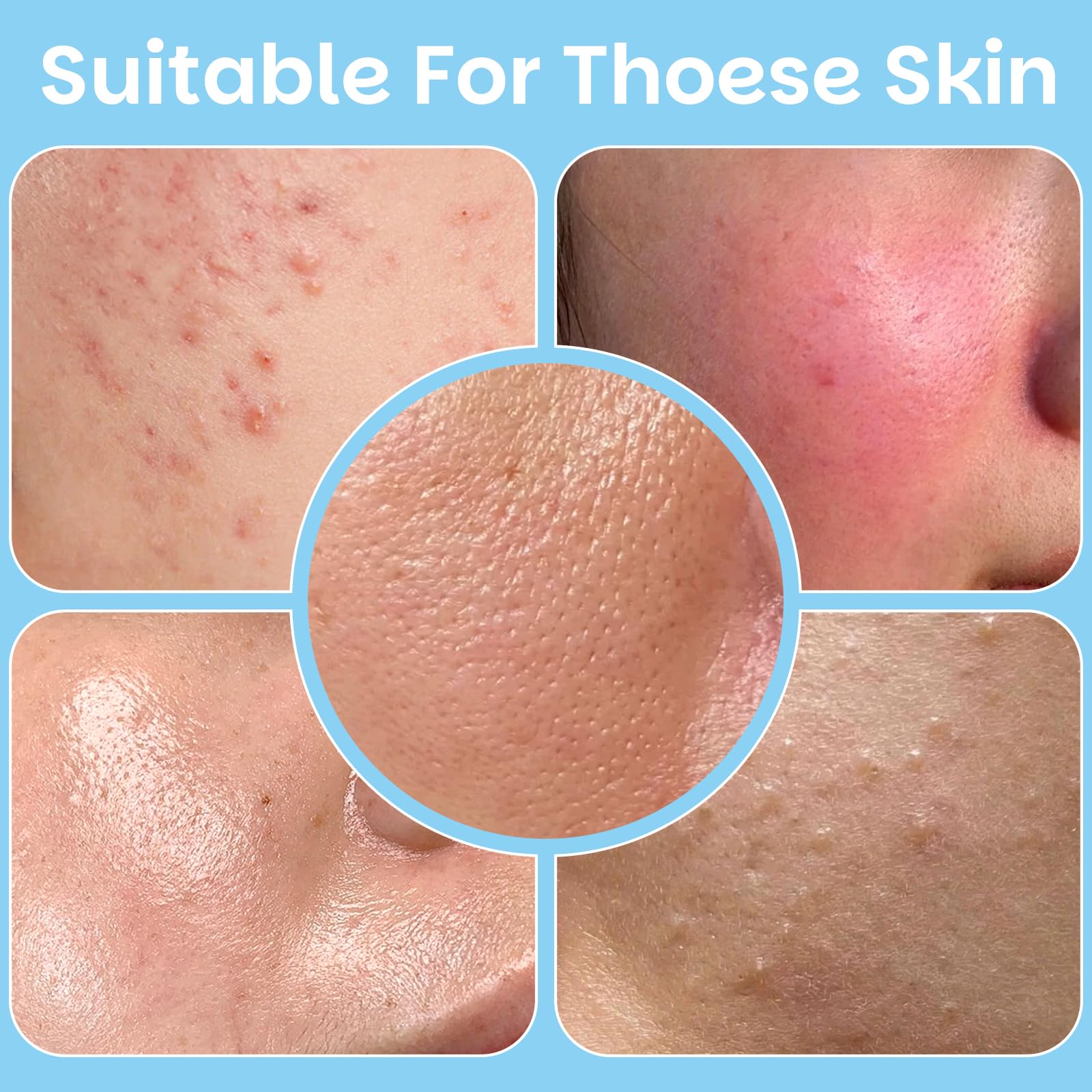 Kestper Witch Hazel blend bottle highlights centella and antioxidants.