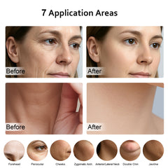 Keylitos red-light therapy with seven modes for customizable skincare