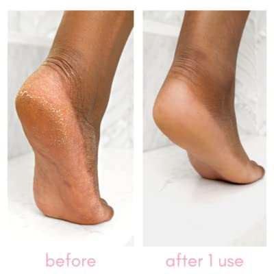 Kiara Sky Heeling Callus Remover Set application brush enables targeted treatment on heels
