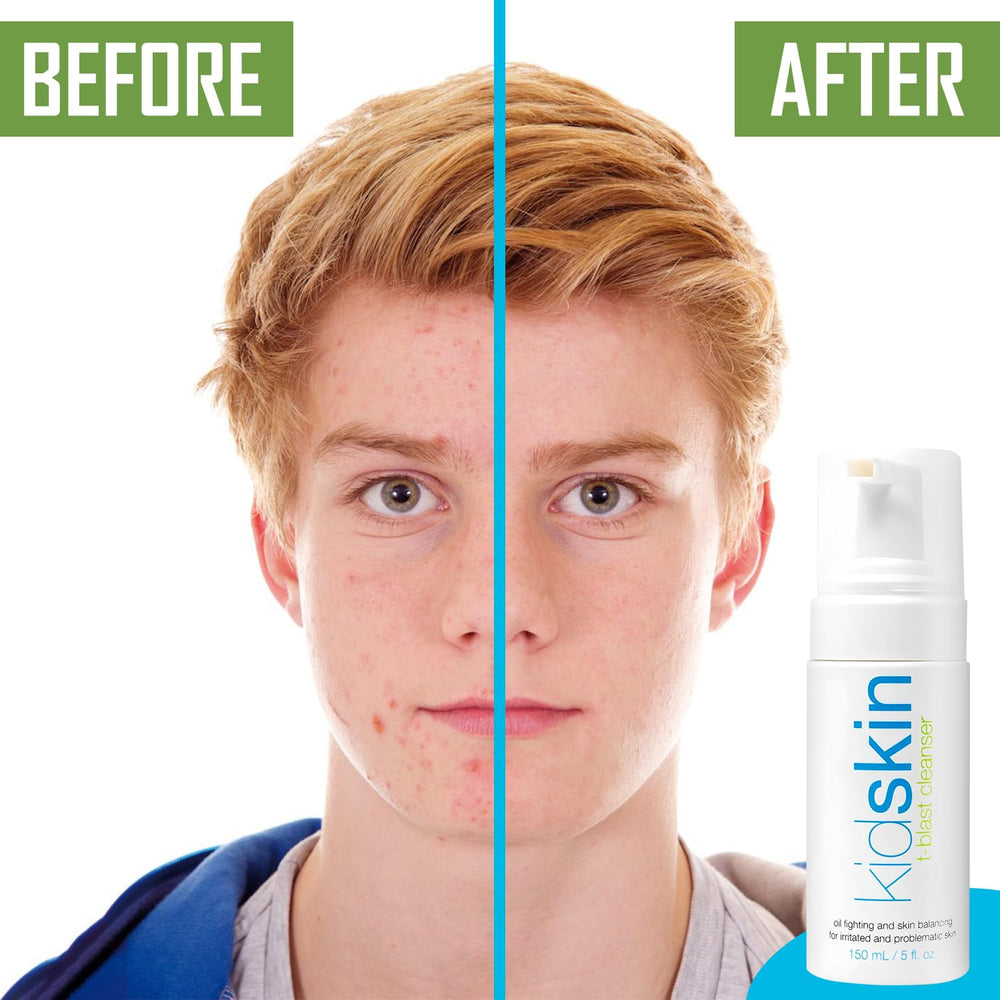 Close packaging image of Kidskin T-Blast cleanser and labeling.